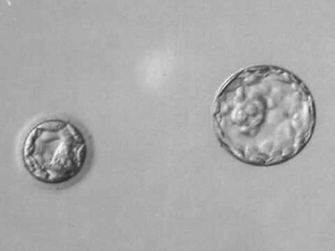 胚盤胞（大きい方は拡張した胚盤胞）