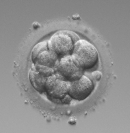 16細胞期　compaction胚