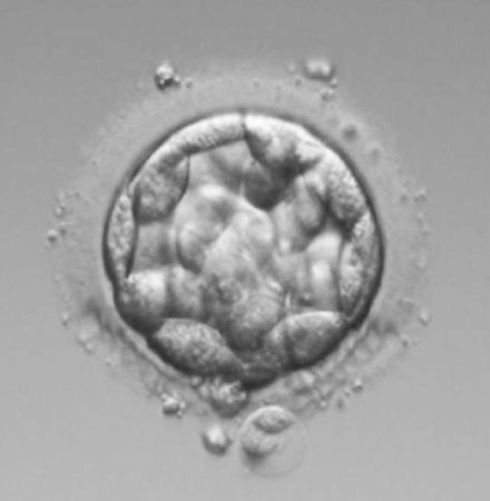 孵化中胚盤胞